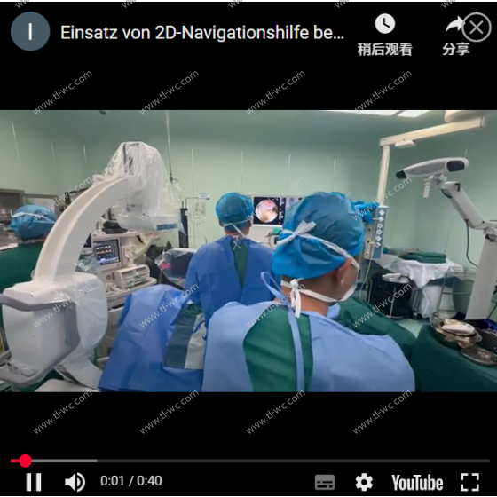 Two-dimensional navigation combined with QuNaMai endoscope for UBE surgery fusion